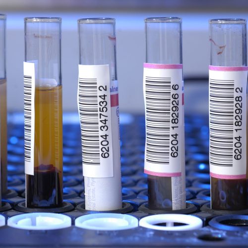 Budget Leaves Blood Cancer Patients in the Lurch